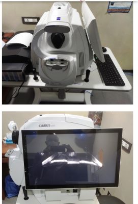 Optical Coherence Tomography Angiography (OCTA)